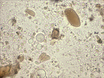 protozoa image