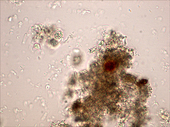 protozoa image